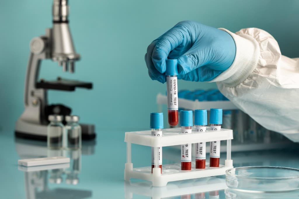 Prélèvement au laboratoire du CDM El Bey